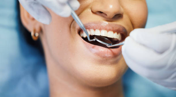 Best Mobile Emergency Dentist in Cascade, ID